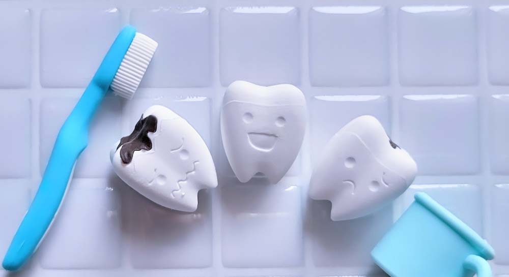 大きな虫歯の治療