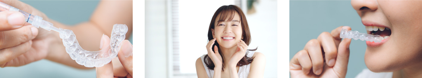 ホワイトニングの価格